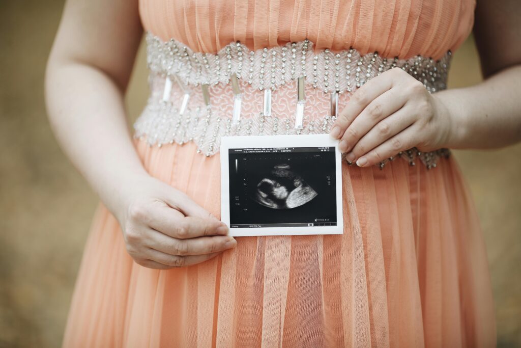 Photographe Grossesse à Perpignan : Sublimez Votre Maternité 6 photographe grossesse perpignan